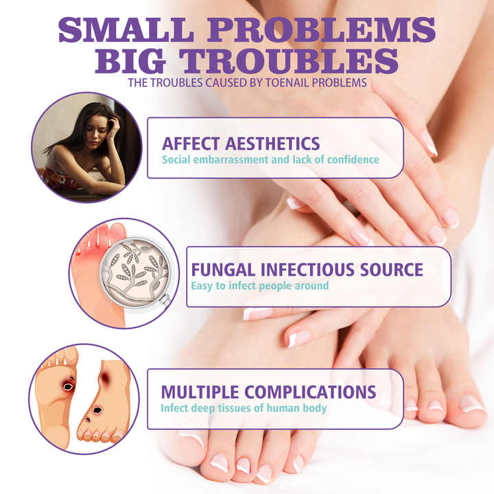 JaySuing Nail Fungus Spray – Natural Anti-Fungal Treatment for Nails
