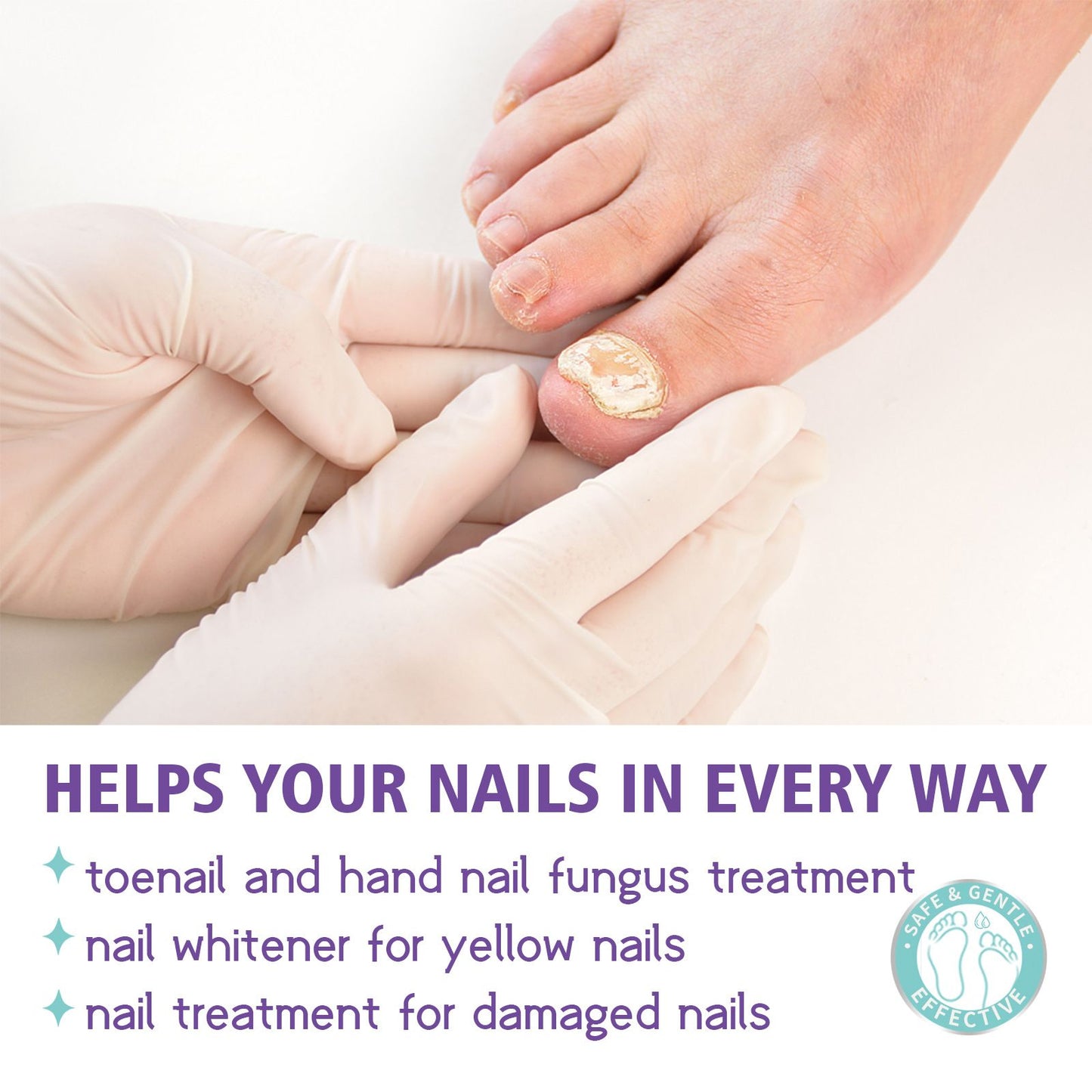JaySuing Nail Fungus Spray – Natural Anti-Fungal Treatment for Nails
